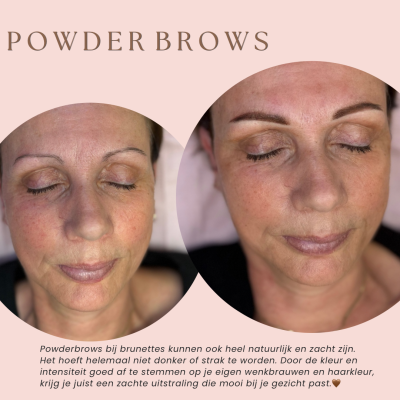 Kopie van 380 Esthetician Instagram Posts (2)