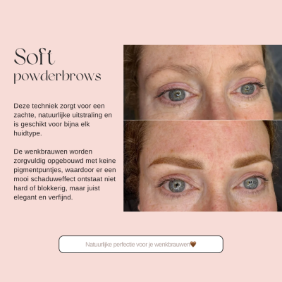 Kopie van 380 Esthetician Instagram Posts (4)